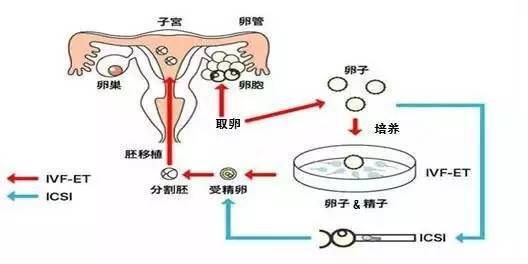 天津试管婴儿技术